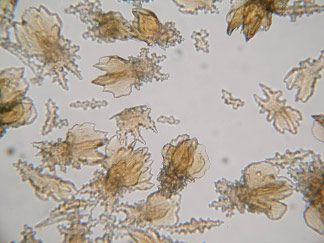 Fig 5. Microscopic sclerites of Paraplexaura sp.