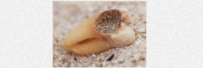 A human tooth on a sandy beach