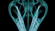 X-ray of Tasmanian Devil